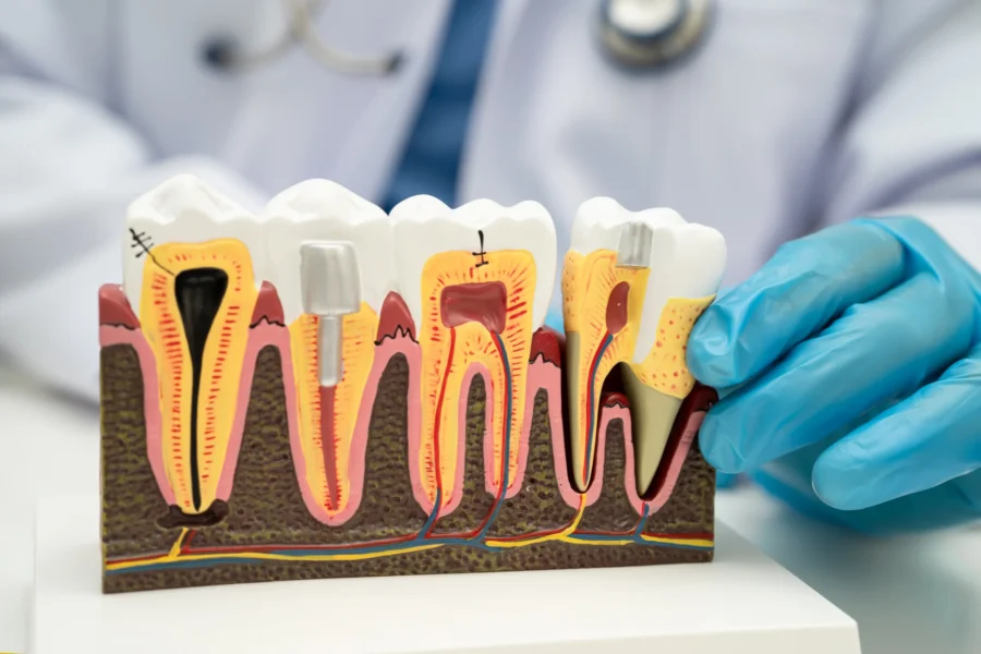 asian-dentist-holding-dental-implant-artificial-t-2026-01-09-10-22-47-utc